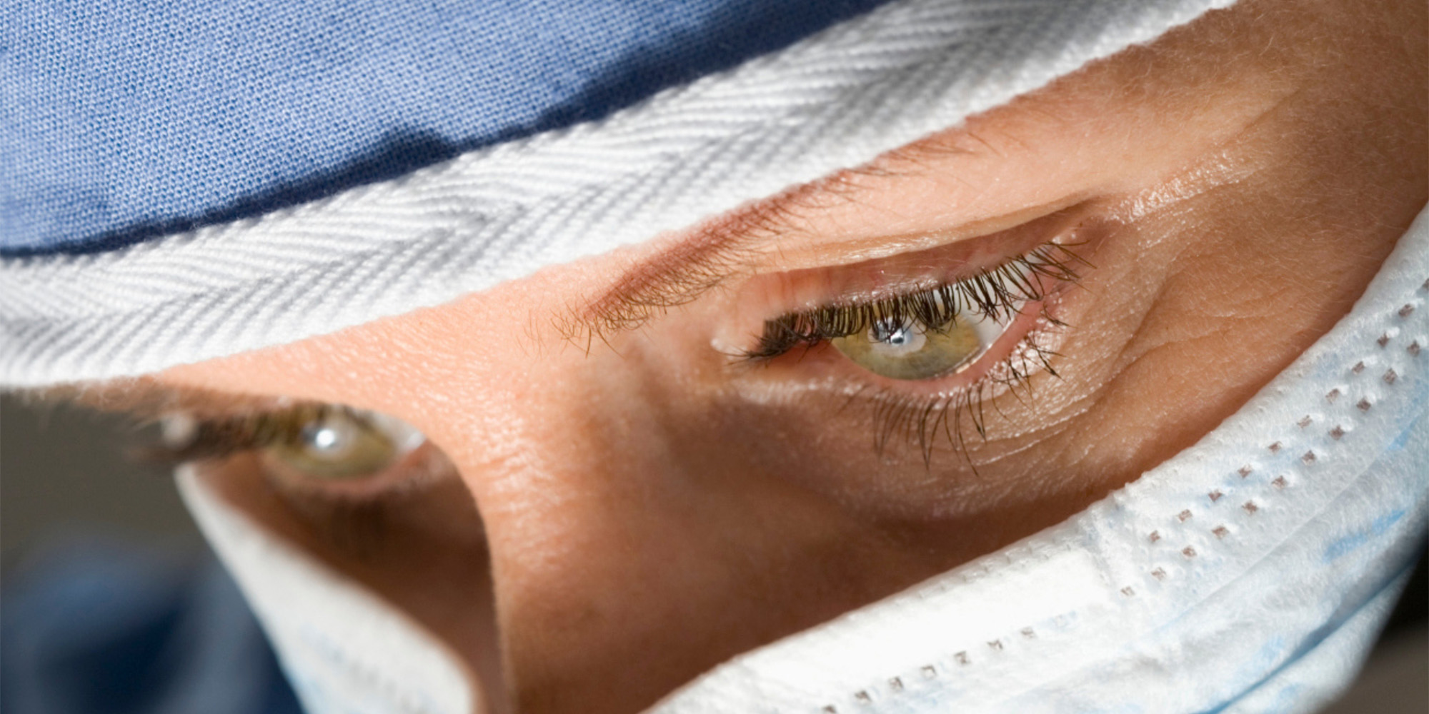 Vanligaste frågor om linsbyte